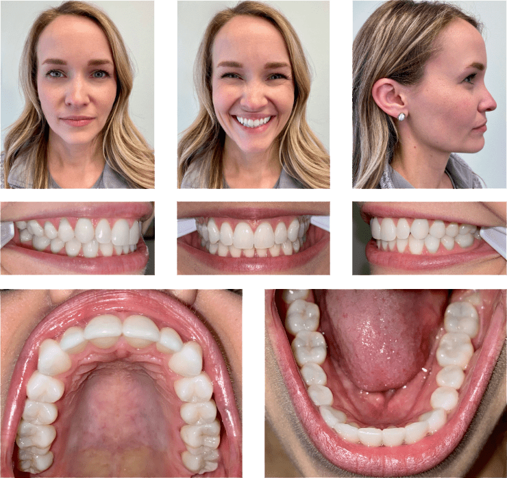 PatientPhotos